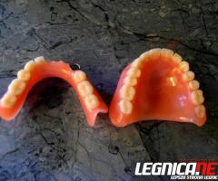 Naprawa protez zębowych – Legnica